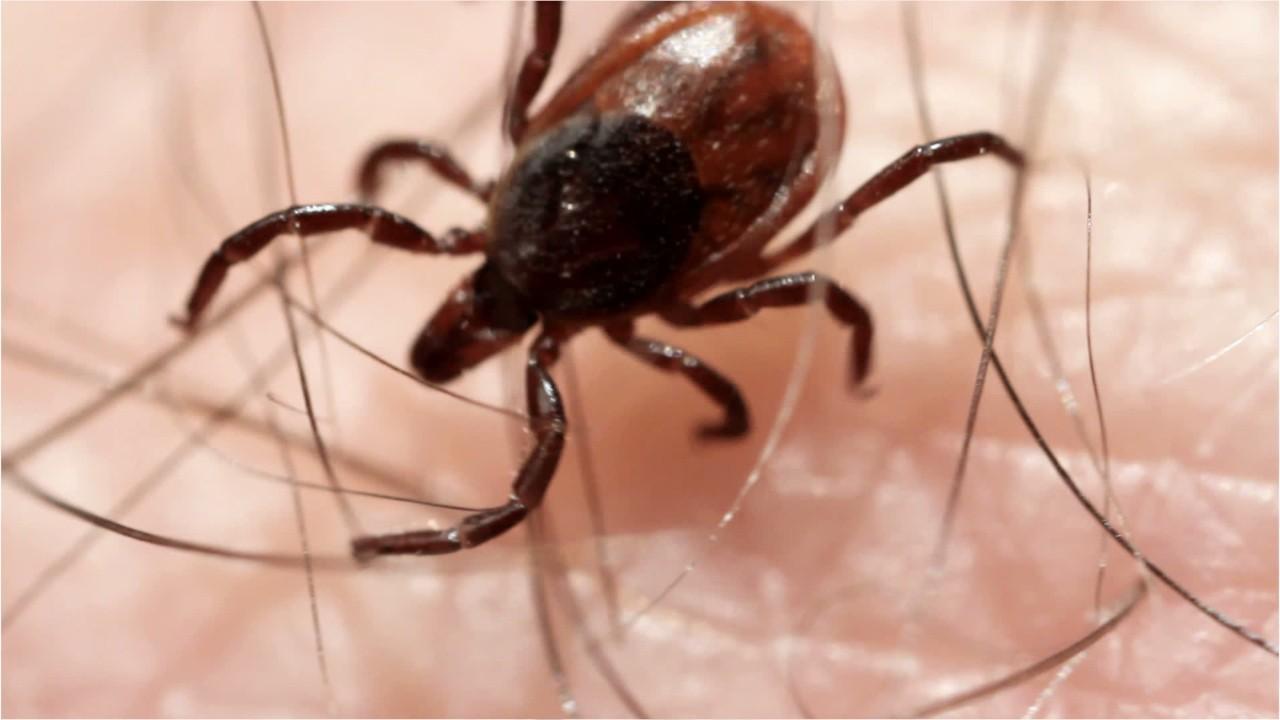 Connecticut resident is state's fourth to contract rare tick-borne illness linked to brain infections, death