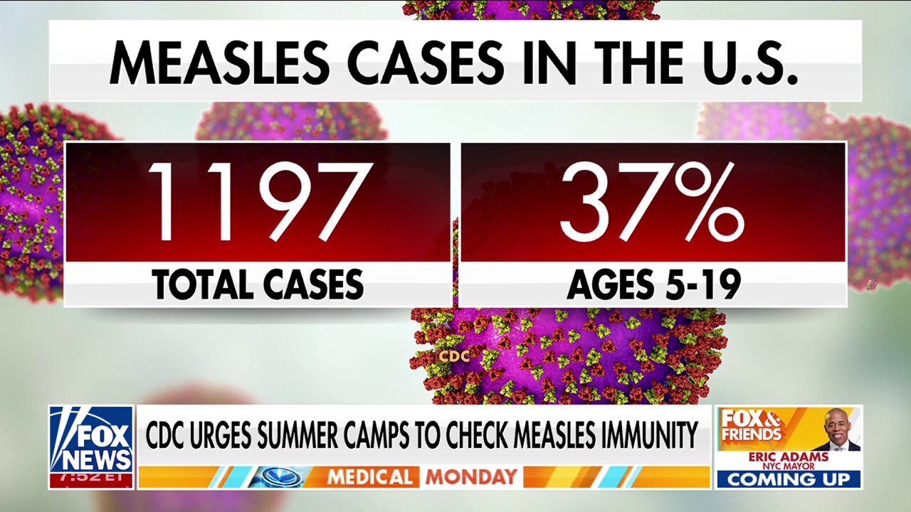 CDC urges summer camps to check for measles immunity 