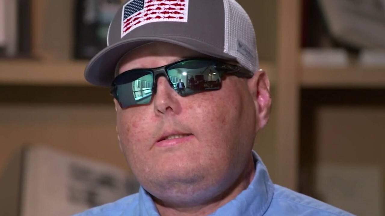 FOX NEWS Firefighter who's face was disfigured said he would run into