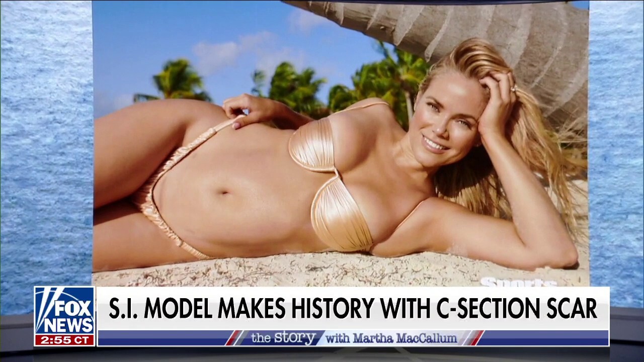 Sports Illustrated model photographed with C-section scar makes history