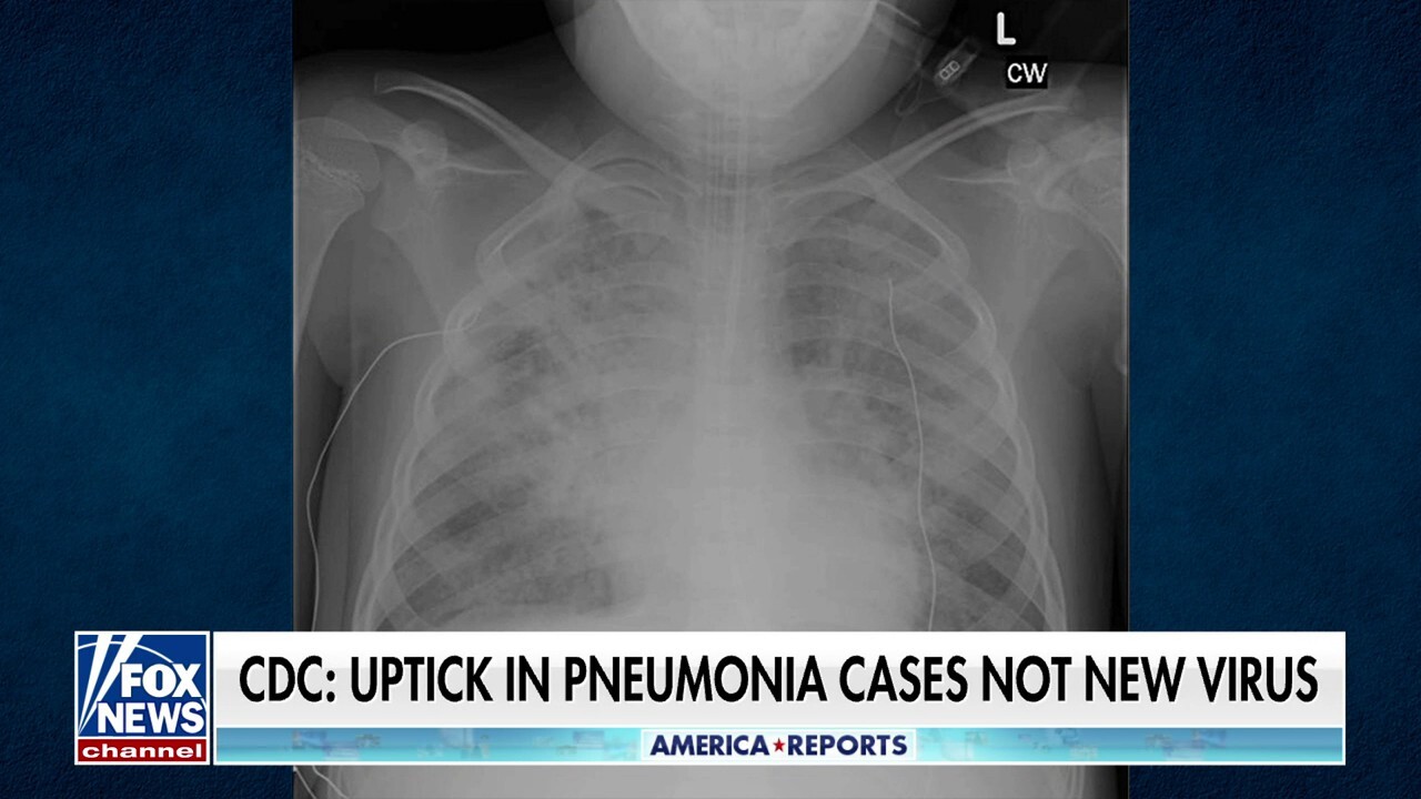 States report spike in child pneumonia cases