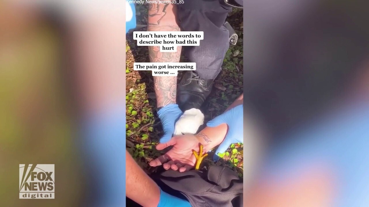 Woman tried to help hawk on side of the road in Florida — then it attacked her