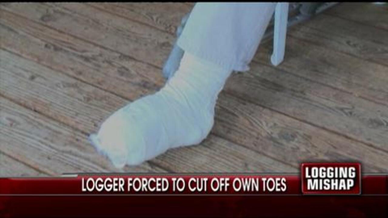 Logger Forced to Cut Off Toes for Safety