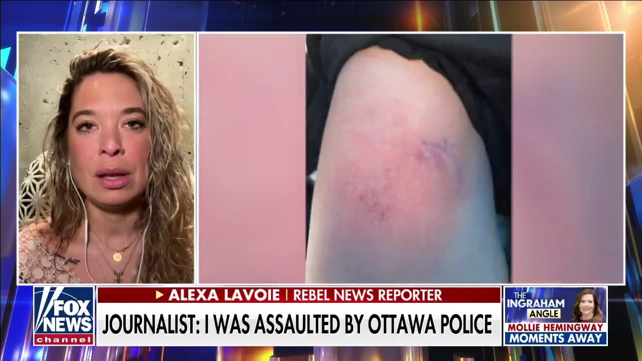 Journalist: I was assaulted by Ottowa police