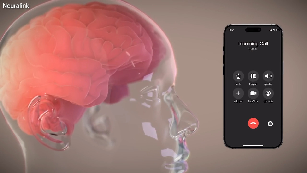 Elon Musk's brain chip startup Neuralink has successfully implanted a device in a human patient