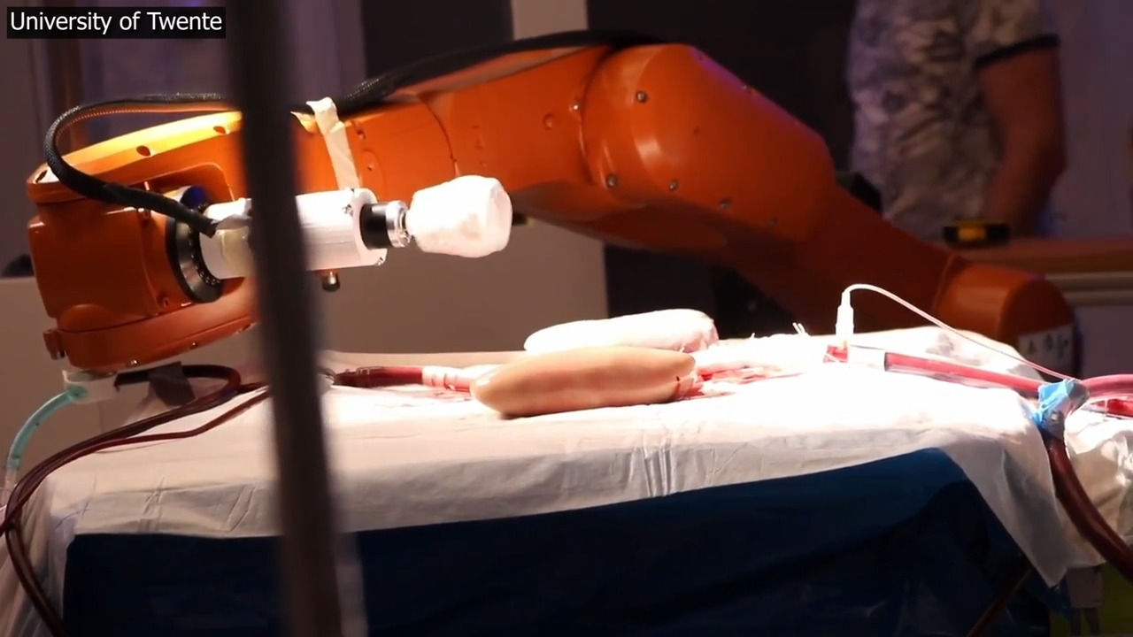 Как малки роботи с тирбушон могат да спасяват животи, като разграждат кръвни съсиреци