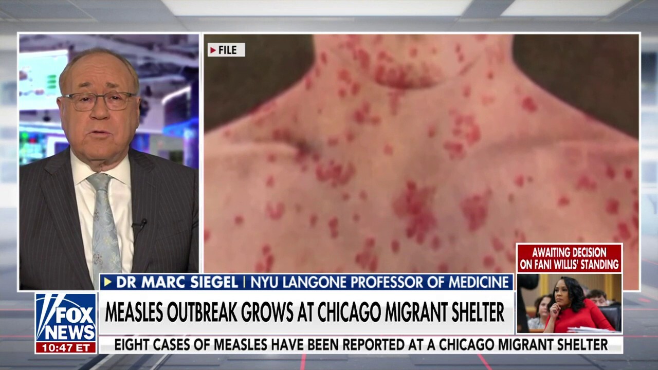 Measles outbreak shouldn't be made political: Dr. Marc Siegel