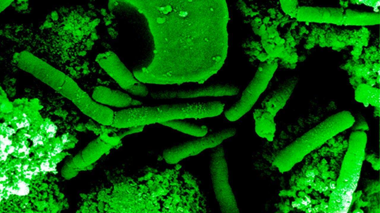 Superbugs could kill 10 million a year by 2050, report finds