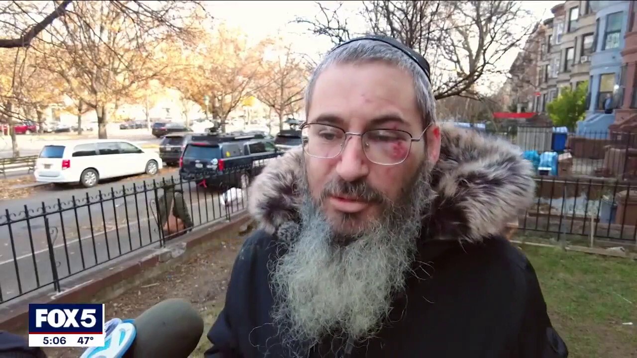 Евреин от Ню Йорк беше удрян и ограбен пред дома си в първия ден на Ханука: „Искам този човек да бъде хванат“