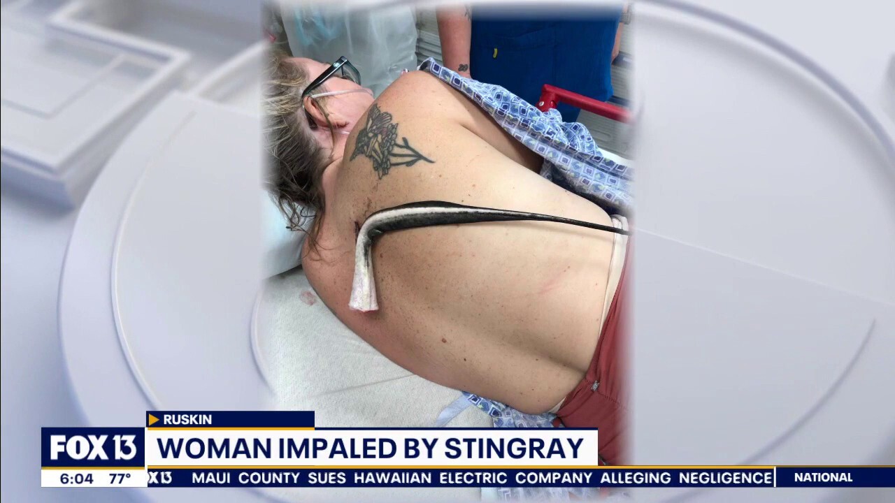 Florida woman impaled in back by stingray