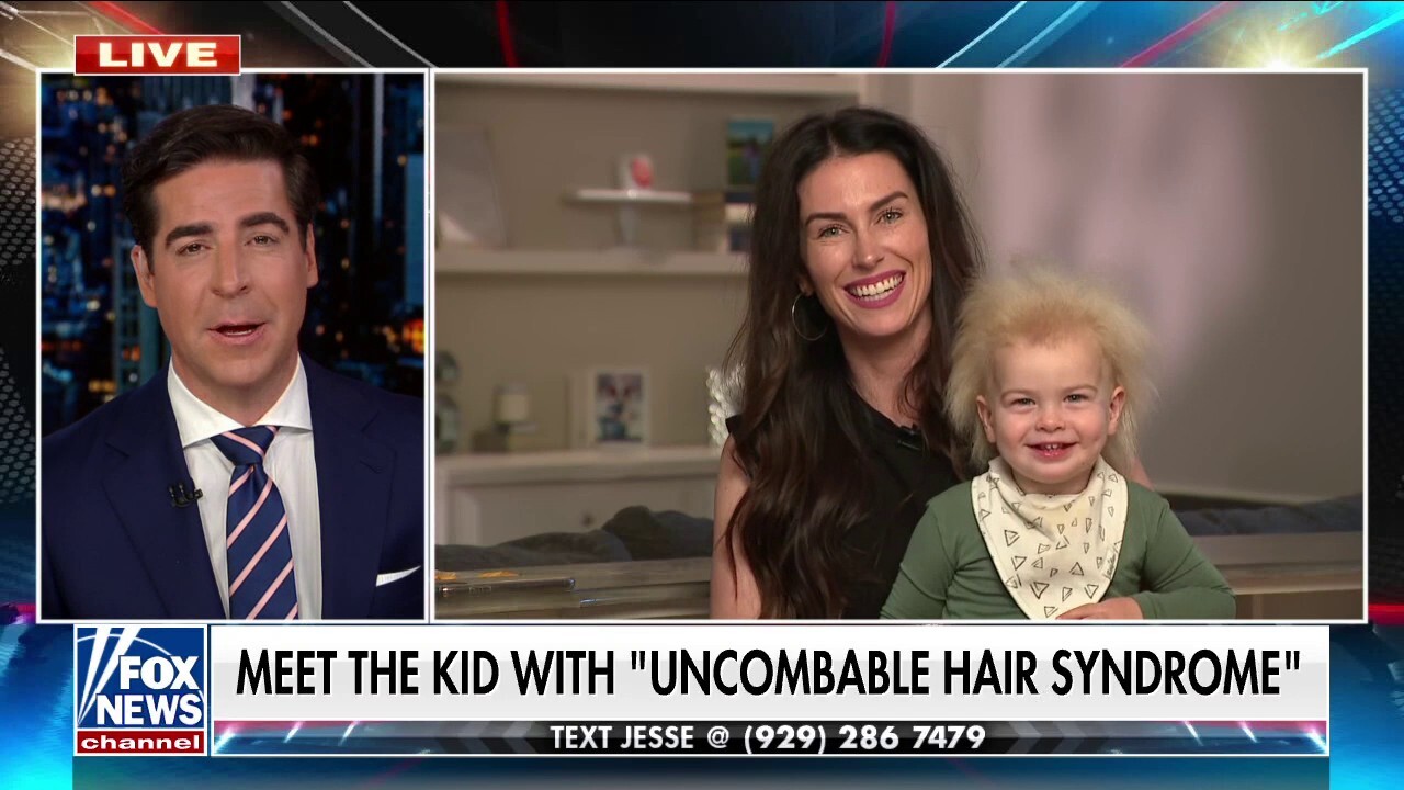 'Did that baby stick his finger in a socket?' -- Meet the boy with 'uncombable hair syndrome'