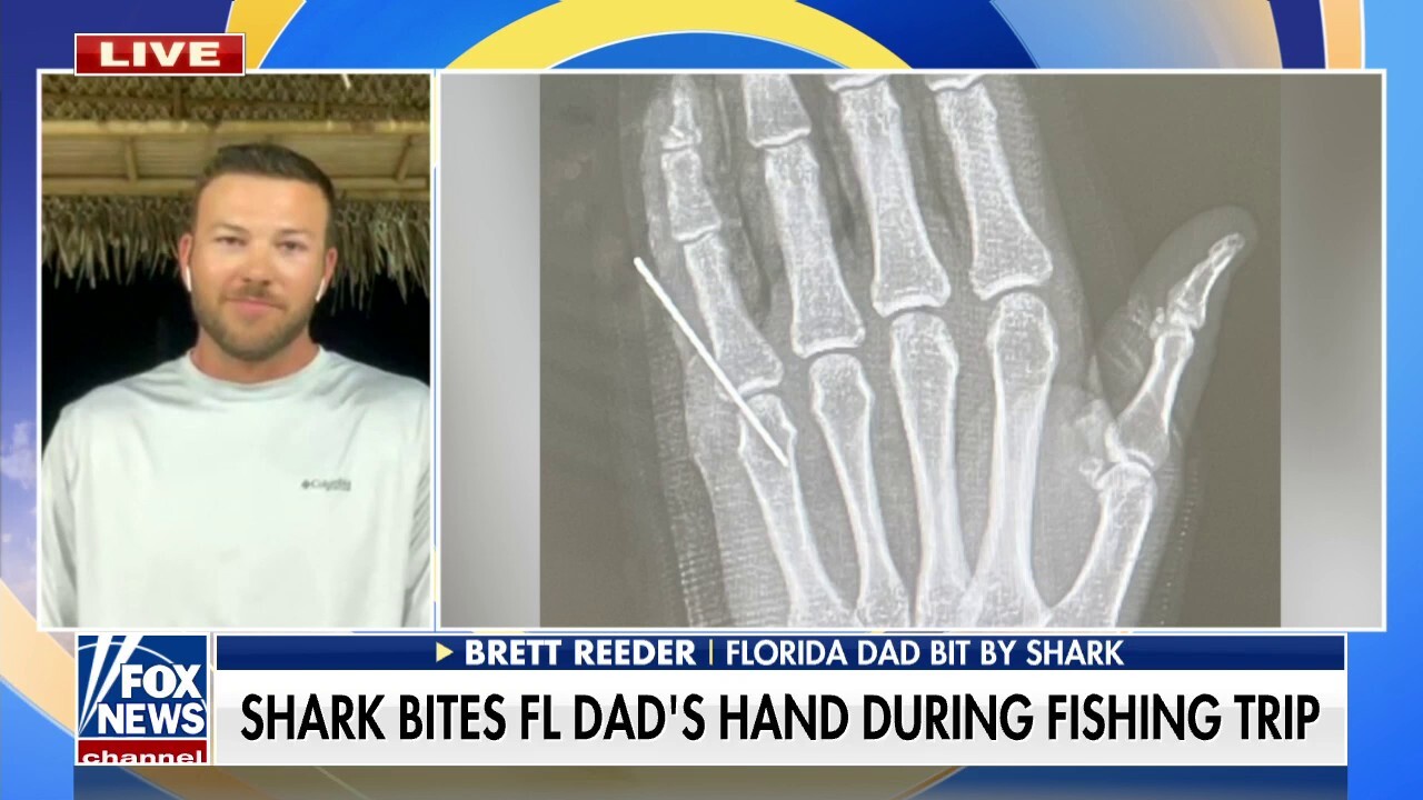 Shark bites Florida dad’s hand while fishing Flipboard