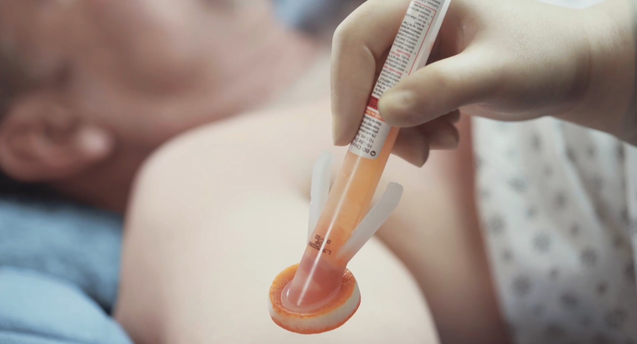 BD ChloraPrep™ Clear 10.5-mL applicator with Sterile Solution