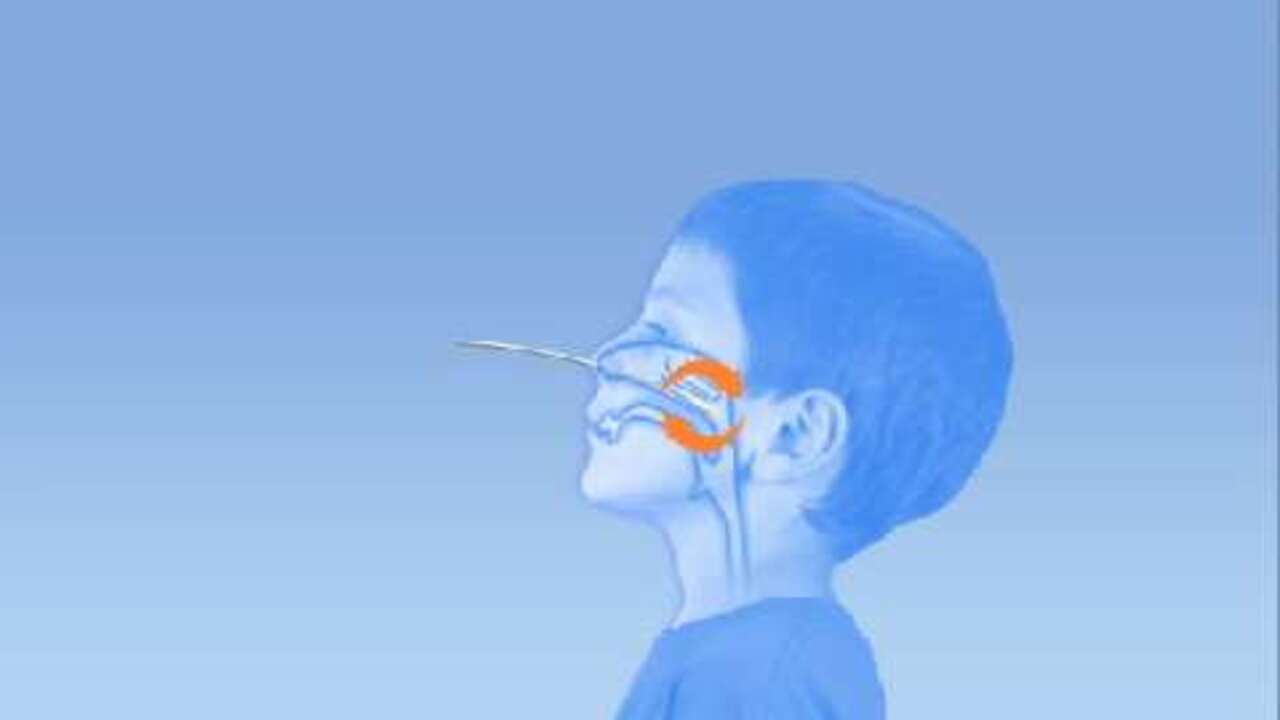 BD Veritor™ System for Rapid Detection of Group A Strep