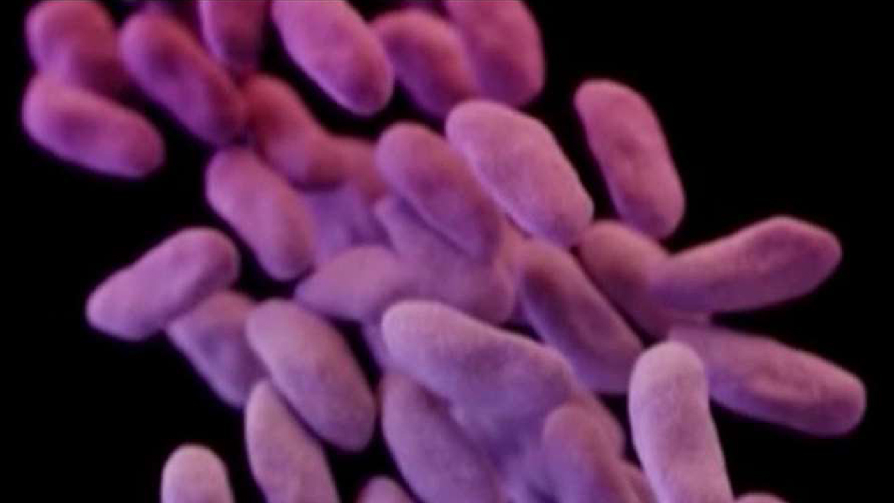 New deadly superbug now in the U.S.