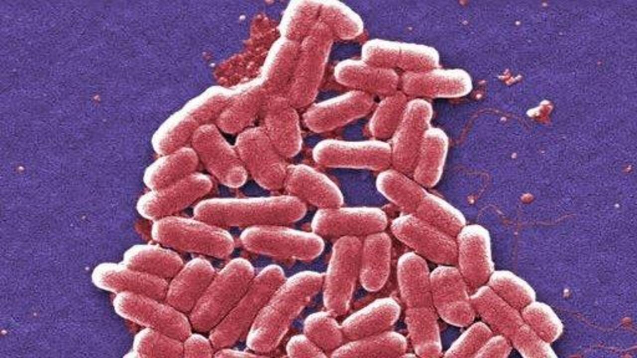 Deadly superbug hits U.S.