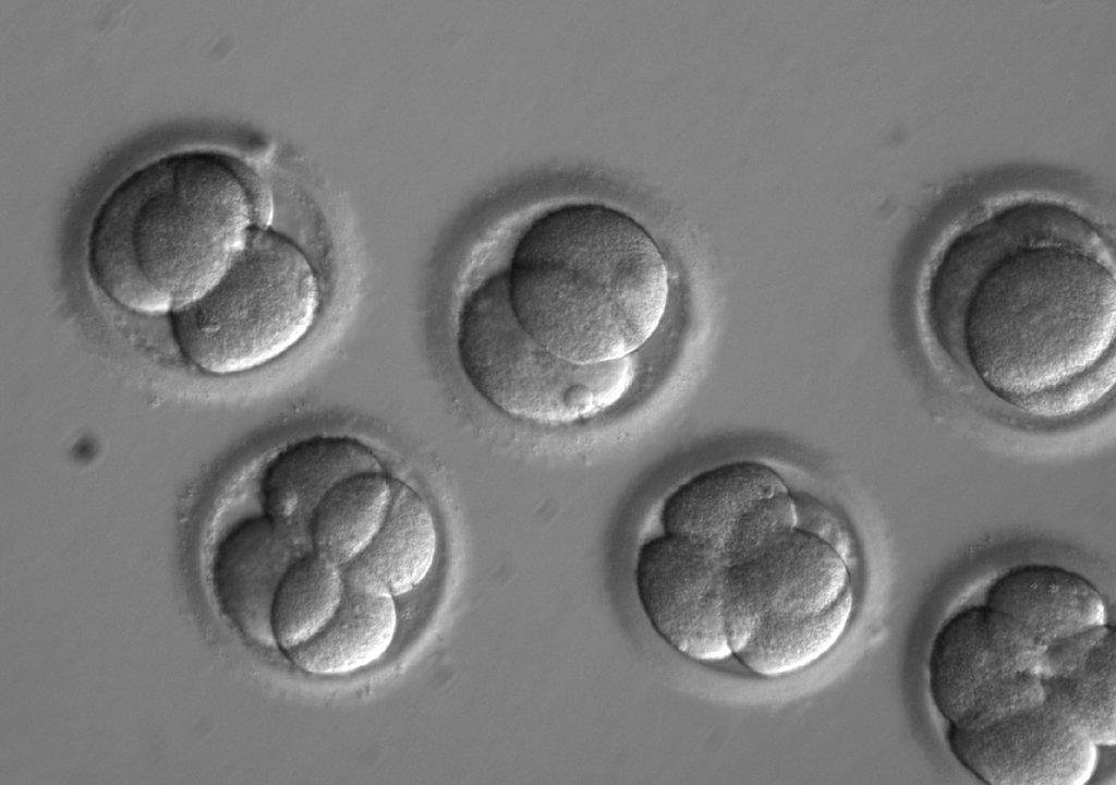Gene editing breakthrough paves way for designer babies: Judge Napolitano
