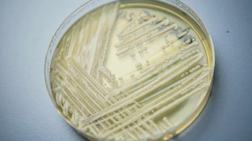 Deadly superbug targeting people globally with weak immune system 