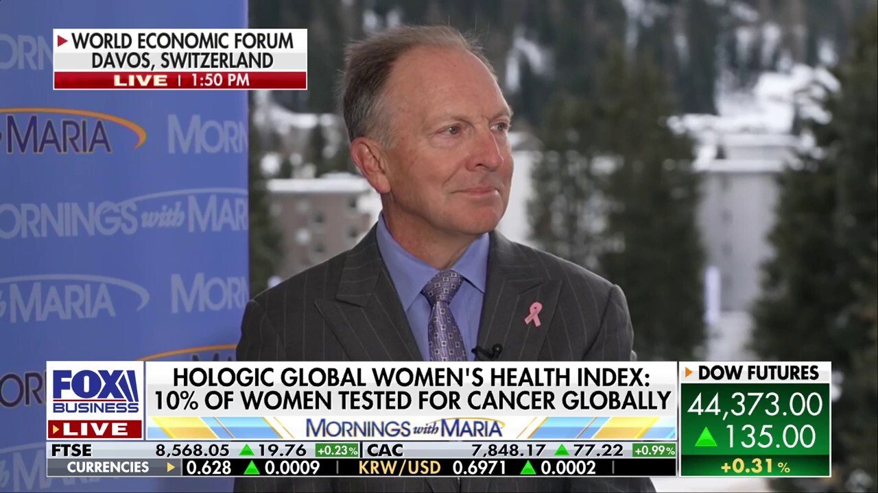 AI can have an incredible impact on healthcare: Hologic CEO