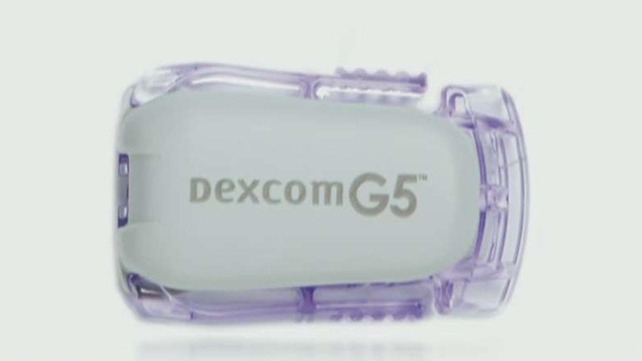 Dexcom now working with Fitbit to help with diabetes management 