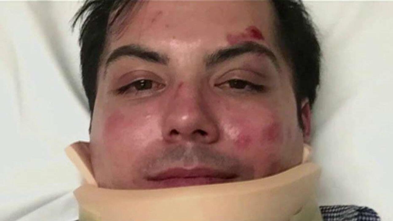 Decorated Marine veteran attacked in D.C., where is the mainstream media?