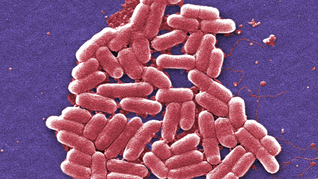 What to know about the antibiotic-resistant superbug