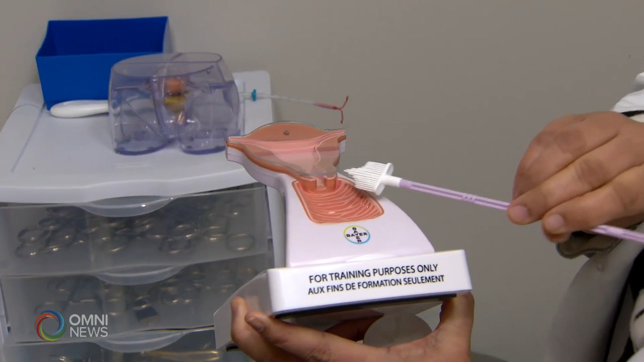 移民女性宫颈癌筛查参与度不高