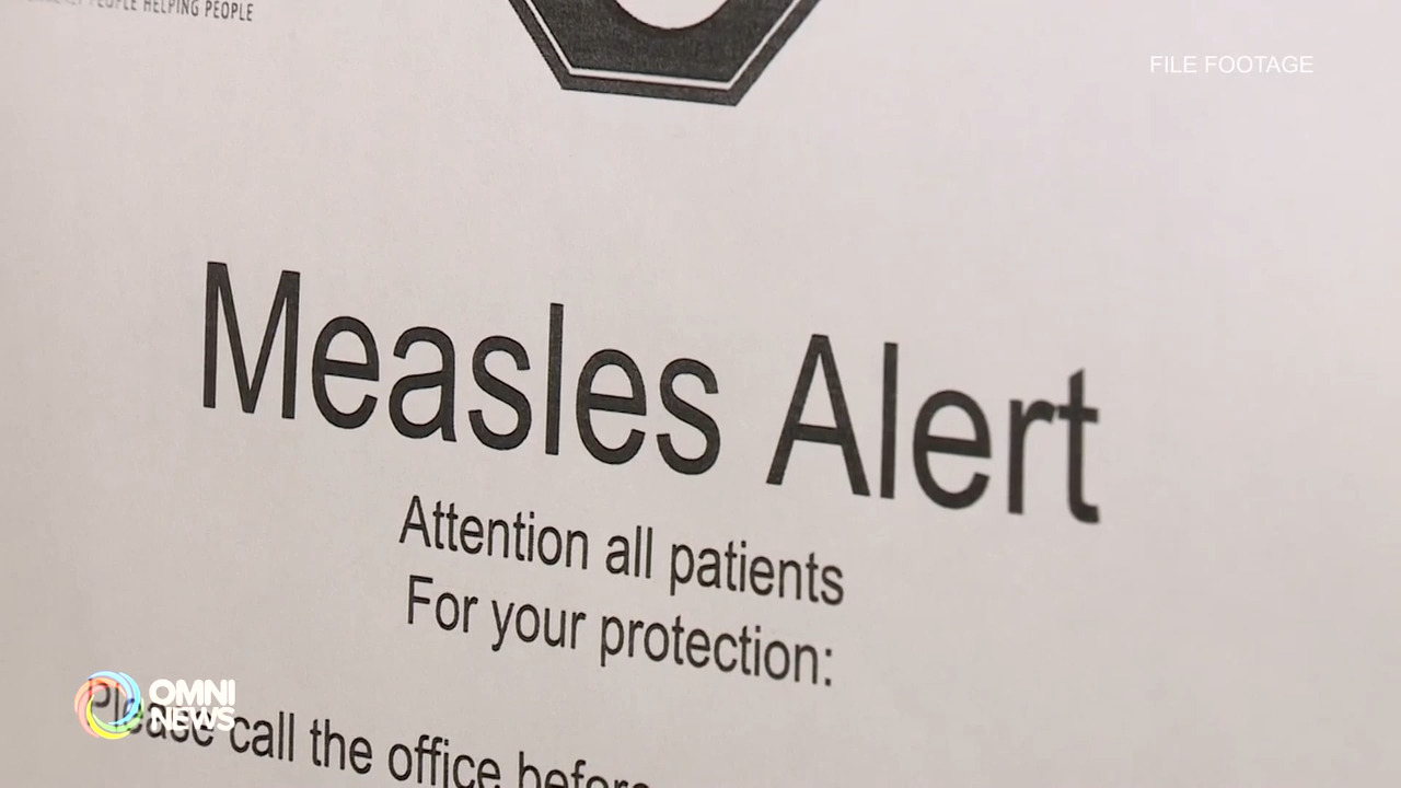 约克区卫生局调查一起特别的麻疹病例