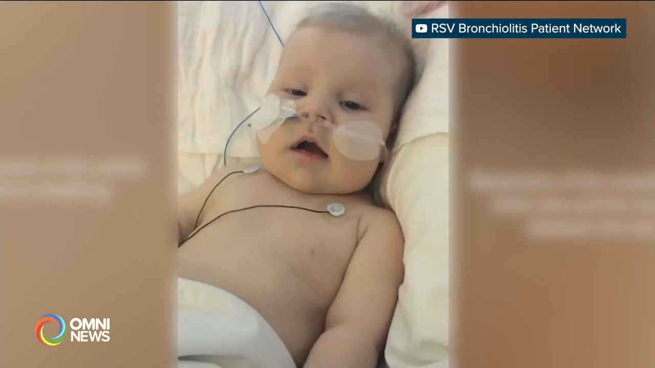 感染呼吸道合胞病毒RSV的兒童急劇增加 (ON)