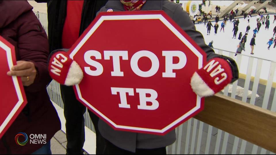 Mahigit 90% ng tuberculosis...