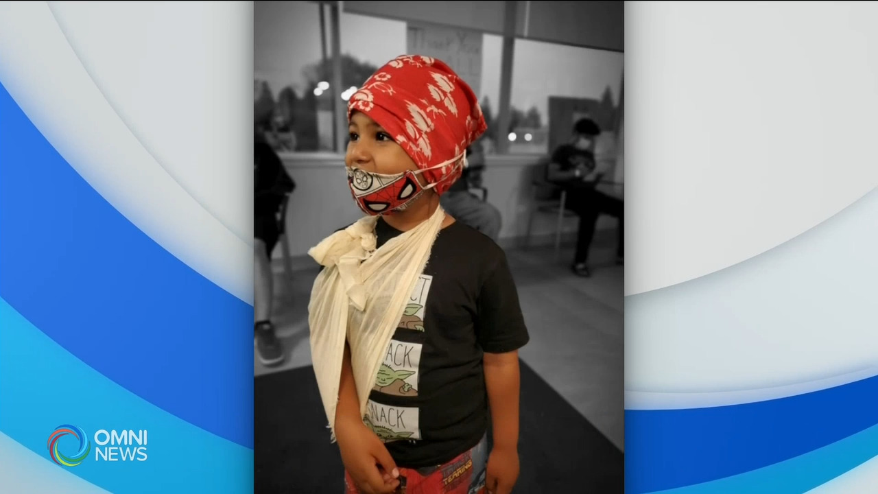 Brampton dad makes 3D printed cast for son | OMNI News Punjabi
