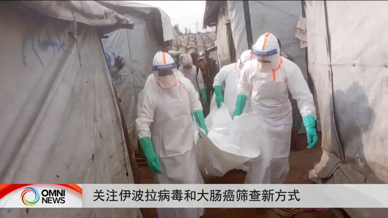 关注伊波拉病毒和大肠癌筛查新方式