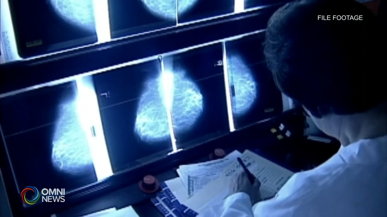 Mammografie dopo i 50 anni, Antonietta Gelfusa ci racconta la sua storia