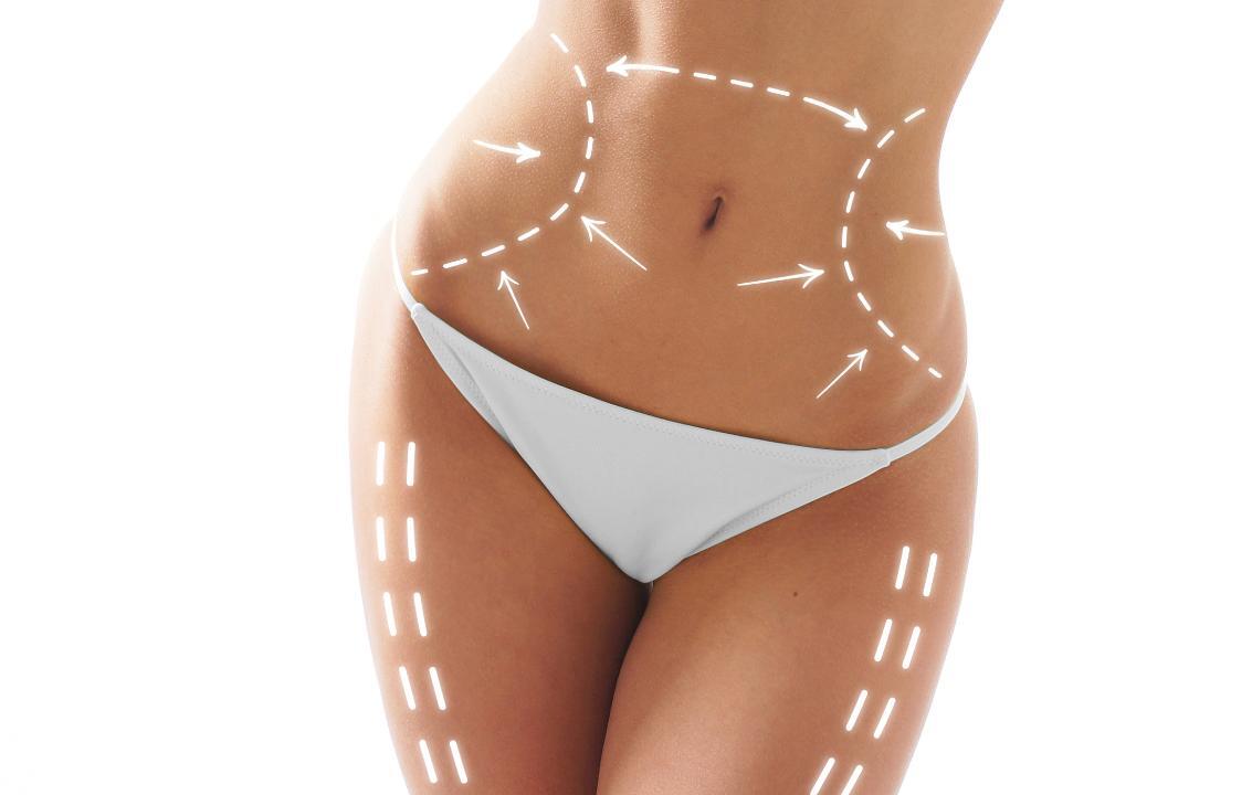 How Much Does a Tummy Tuck Cost? – Craig W. Colville MD, FACS