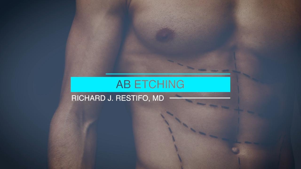 Ab sculpting is a plastic surgery procedure that sculpts the abdominal  contours to create the appearanc…
