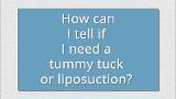 How Much Does a Tummy Tuck Cost? – Craig W. Colville MD, FACS