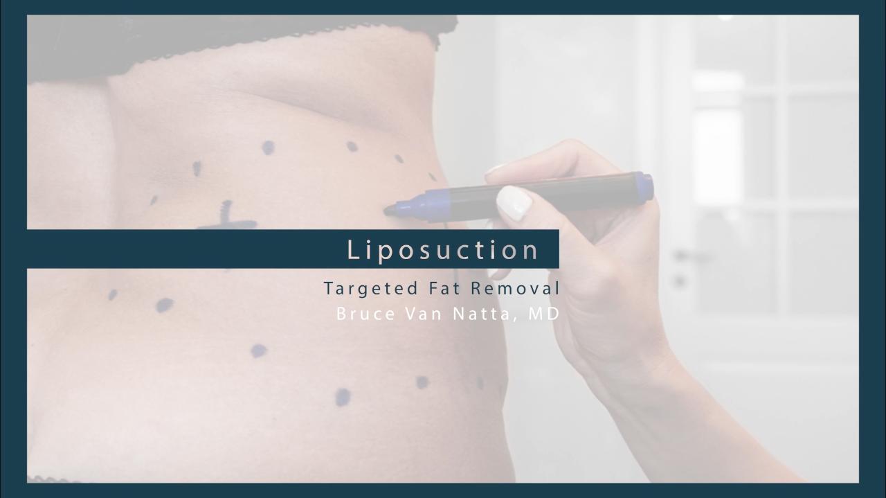Liposuction Recovery: Depression After Liposuction