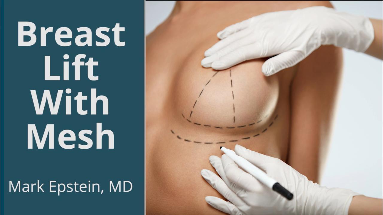 GalaFLEX Mesh is a knitted surgical implant that supports breast tissue  during a breast lift or revision to provide extra strength to the tissue  and, By Dr. John Diaz