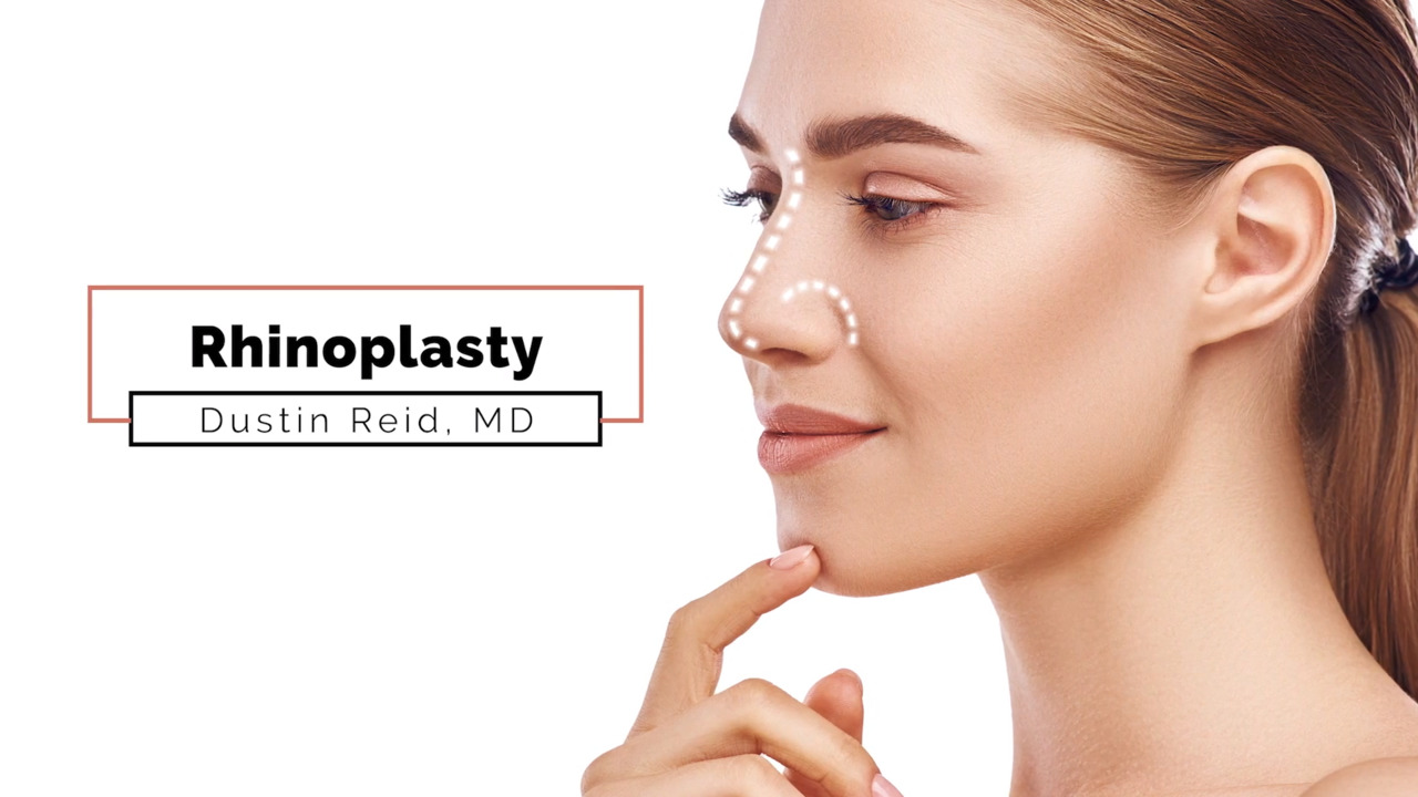 Plastic Surgeon or ENT for Your Rhinoplasty? - The Plastic Surgery